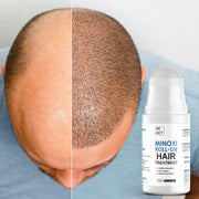 roll-on hair growth serum