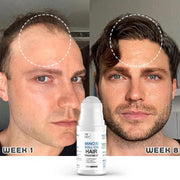 roll-on hair growth serum