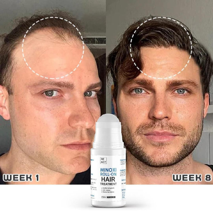 roll-on hair growth serum